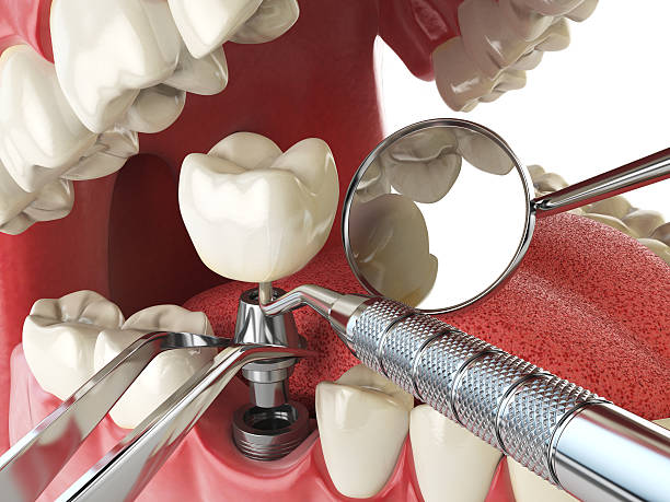 Best Mobile Emergency Dentist in Woodlake, CA
